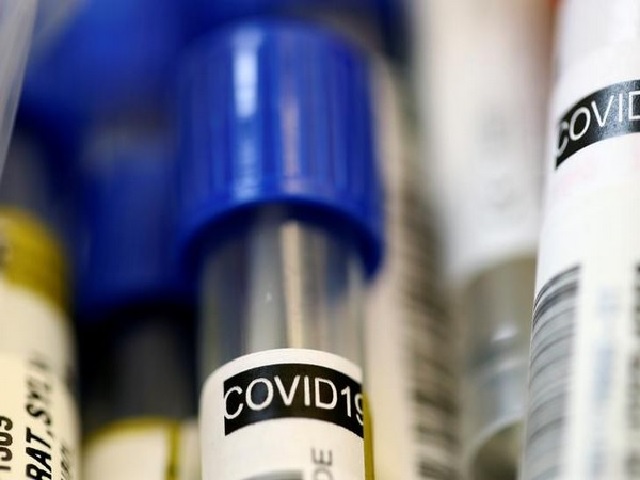 Patient recovered from Plasma Therapy